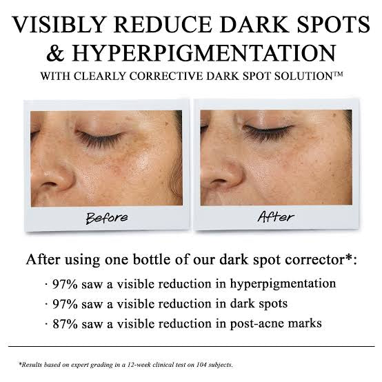 Buy Original Kiehls Clearly Corrective Dark Spot Solution Online in Pakistan | Rack Essentials - ozeefy